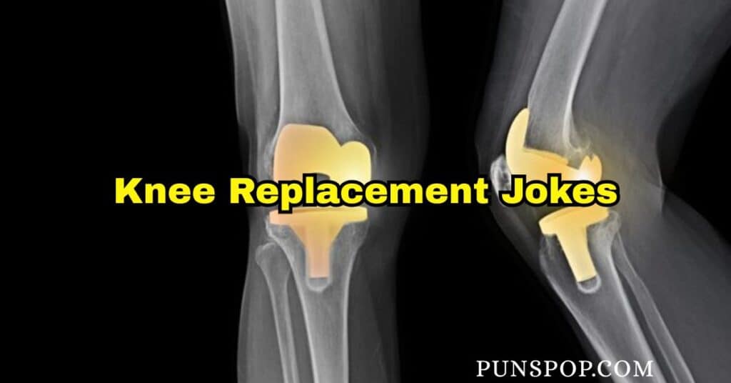 65+ Knee Replacement Jokes That’ll Crack You Up (Not Your Joint!) 😄🦿